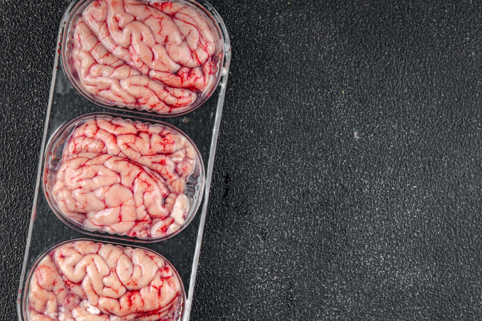 pork-brain-raw-edible-offal-meat-food-tasty-fresh-eating-cooking-meal-food-snack-table (1).jpg